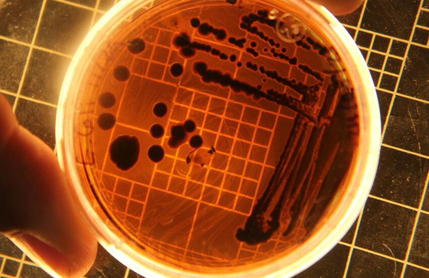 bacterial colonies shown under a light